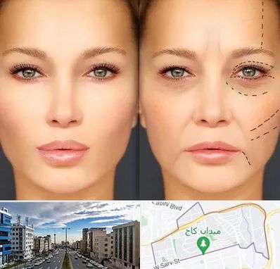 متخصص زیبایی چشم در سعادت آباد 