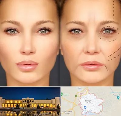 متخصص زیبایی چشم در برازجان