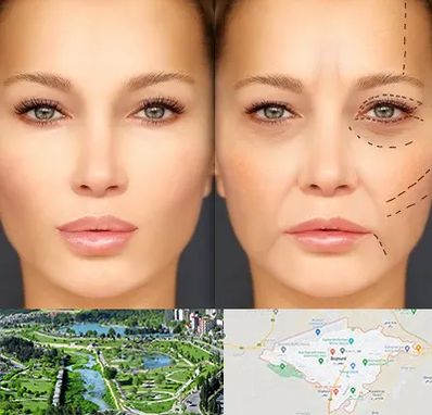 متخصص زیبایی چشم در بجنورد