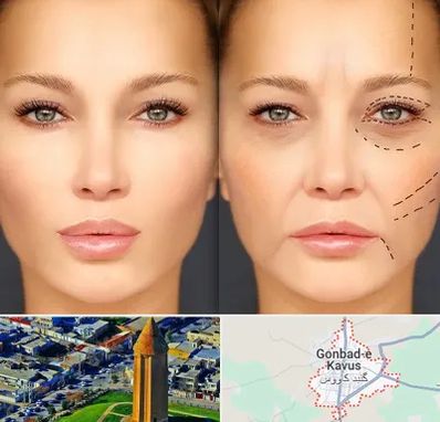 متخصص زیبایی چشم در گنبد کاووس