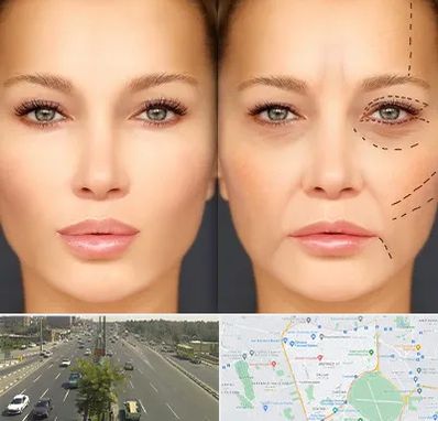 متخصص زیبایی چشم در منطقه 17 تهران 