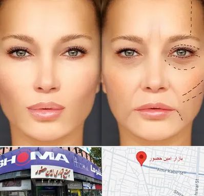 متخصص زیبایی چشم در امین حضور