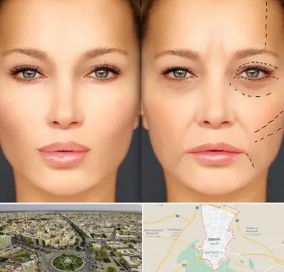 متخصص زیبایی چشم در قزوین