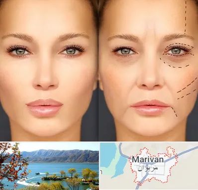متخصص زیبایی چشم در مریوان