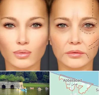 متخصص زیبایی چشم در عباس آباد