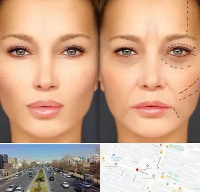 متخصص زیبایی چشم در بلوار معلم مشهد 