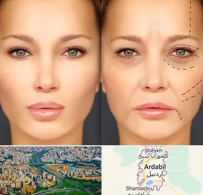 متخصص زیبایی چشم در اردبیل
