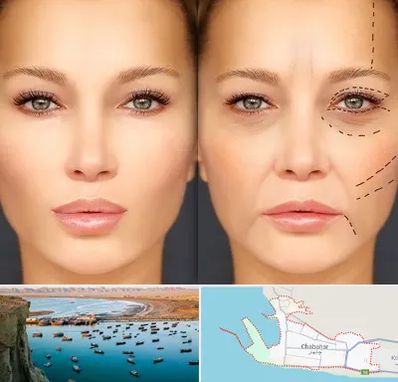 متخصص زیبایی چشم در چابهار