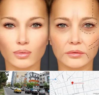 متخصص زیبایی چشم در هفده شهریور تبریز