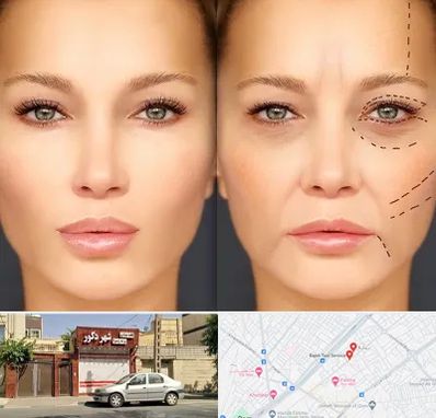 متخصص زیبایی چشم در باجک قم