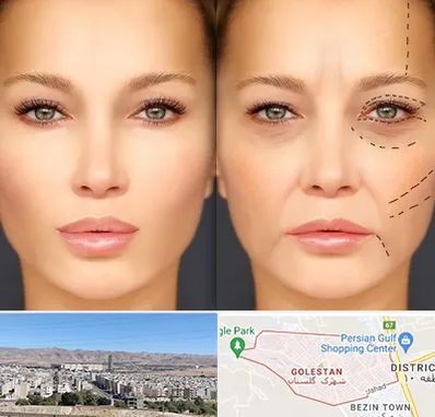 متخصص زیبایی چشم در شهرک گلستان شیراز