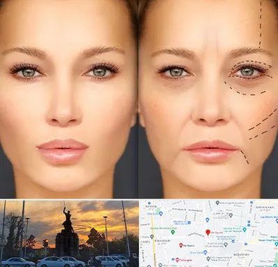 متخصص زیبایی چشم در میدان حر 