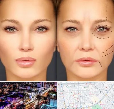 متخصص زیبایی چشم در منظریه رشت