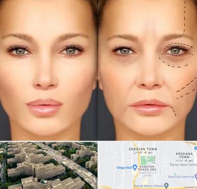 متخصص زیبایی چشم در اکباتان 