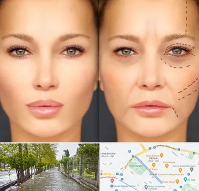 متخصص زیبایی چشم در خیابان ارم شیراز