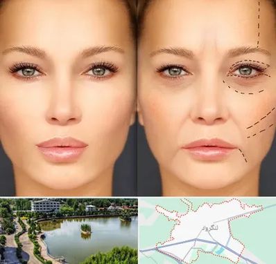 متخصص زیبایی چشم در لنگرود