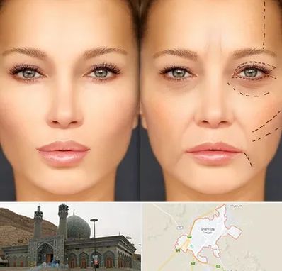 متخصص زیبایی چشم در شهرضا