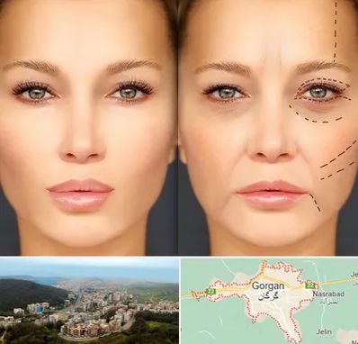 متخصص زیبایی چشم در گرگان
