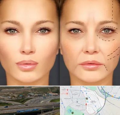 متخصص زیبایی چشم در یاغچیان تبریز