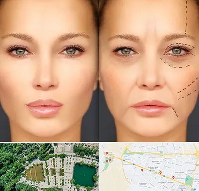 متخصص زیبایی چشم در وکیل آباد مشهد 