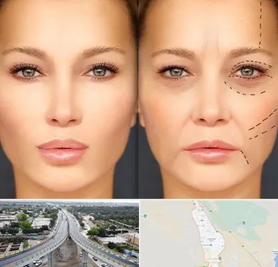 متخصص زیبایی چشم در اندیمشک