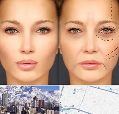 متخصص زیبایی چشم در ازگل