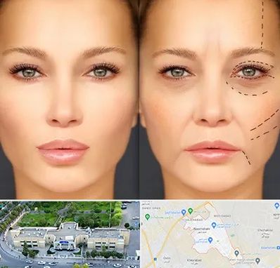 متخصص زیبایی چشم در نسیم شهر