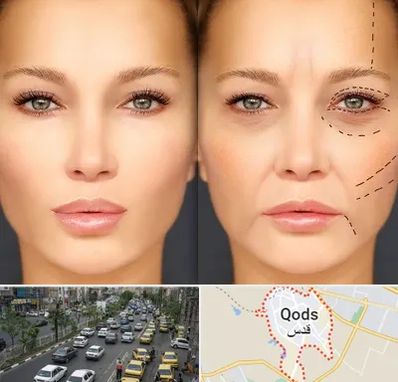 متخصص زیبایی چشم در شهر قدس