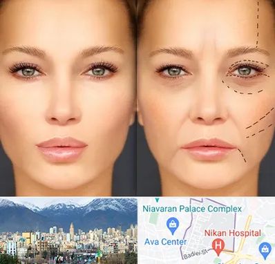 متخصص زیبایی چشم در آجودانیه 