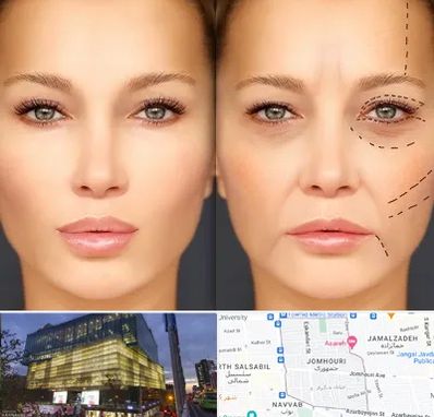 متخصص زیبایی چشم در جمهوری 