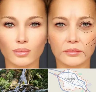 متخصص زیبایی چشم در الیگودرز