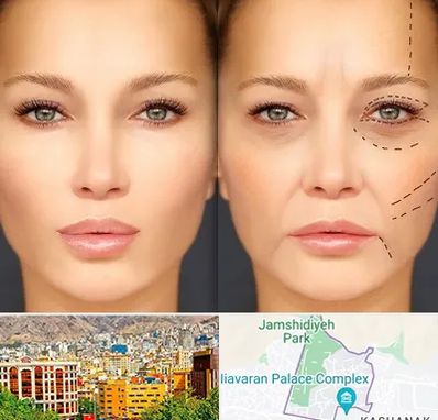 متخصص زیبایی چشم در نیاوران 