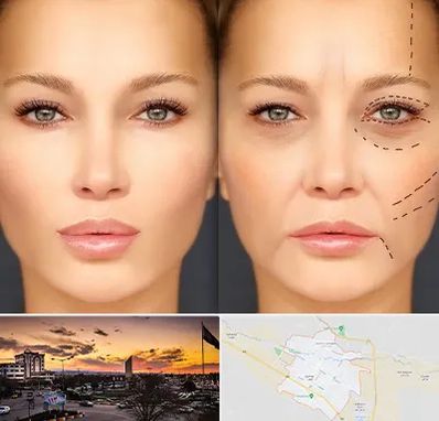 متخصص زیبایی چشم در قوچان