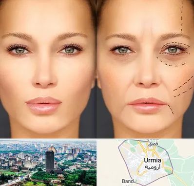 متخصص زیبایی چشم در ارومیه