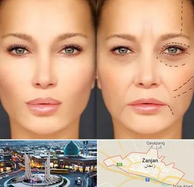 متخصص زیبایی چشم در زنجان