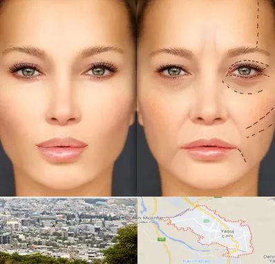 متخصص زیبایی چشم در یاسوج