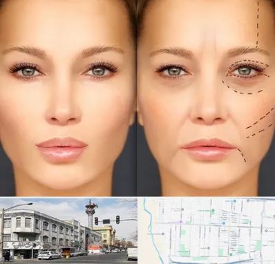 متخصص زیبایی چشم در 17شهریور