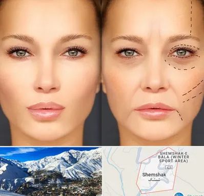 متخصص زیبایی چشم در شمشک