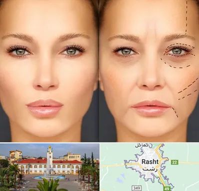 متخصص زیبایی چشم در رشت