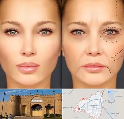 متخصص زیبایی چشم در ایرانشهر