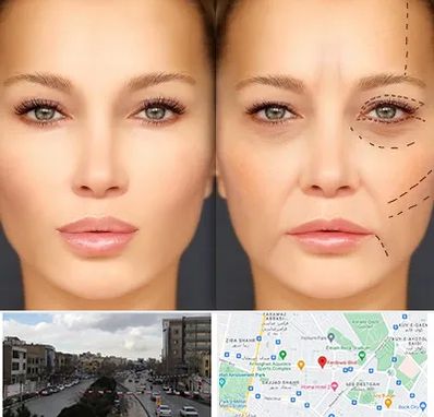 متخصص زیبایی چشم در بلوار فردوسی مشهد 