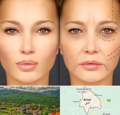 متخصص زیبایی چشم در آمل