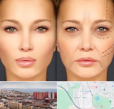 متخصص زیبایی چشم در سهند تبریز