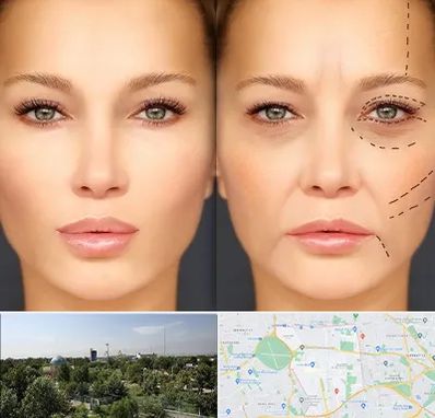 متخصص زیبایی چشم در منطقه 16 تهران 