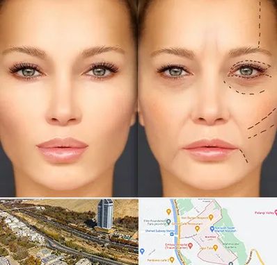 متخصص زیبایی چشم در خیابان نیایش شیراز