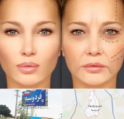 متخصص زیبایی چشم در فردوسیه شهریار