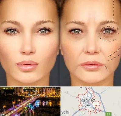 متخصص زیبایی چشم در سقز