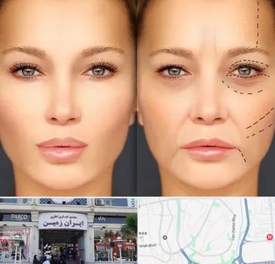 متخصص زیبایی چشم در ایران زمین