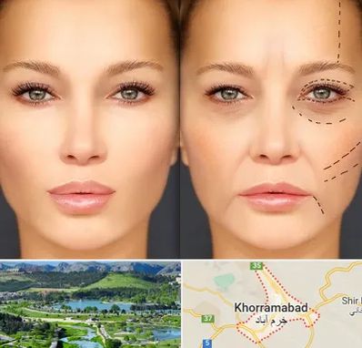 متخصص زیبایی چشم در خرم آباد