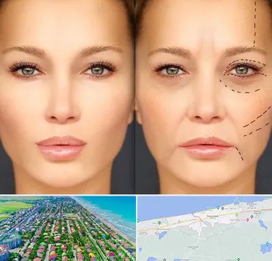 متخصص زیبایی چشم در فریدونکنار